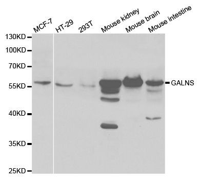 Western blot - GALNS antibody (144-05461)