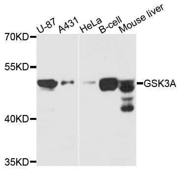 Western blot - GSK3A Polyclonal Antibody (144-00645)