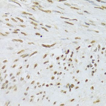 Immunohistochemistry - DDB1 Polyclonal Antibody (144-02896)