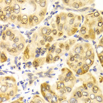 Immunohistochemistry - CPT2 antibody (144-02876)
