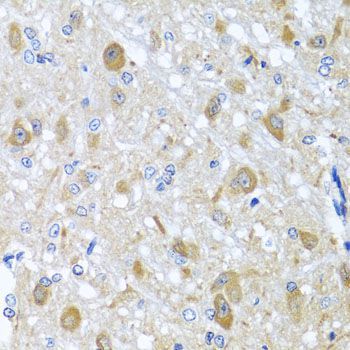 Immunohistochemistry - BNIP3L antibody (144-06283)