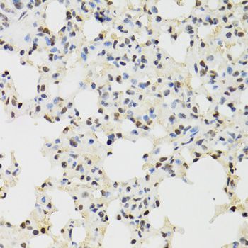 Immunohistochemistry - KDM4A Polyclonal Antibody (144-07953)