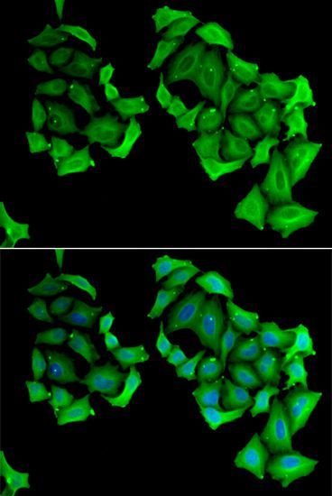 Immunofluorescence - C4BPB antibody (144-06362)