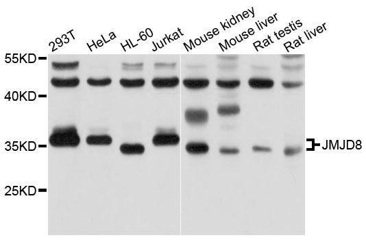 Western blot - JMJD8 Polyclonal Antibody (144-10476)