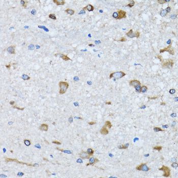 Immunohistochemistry - RARS antibody (144-06307)