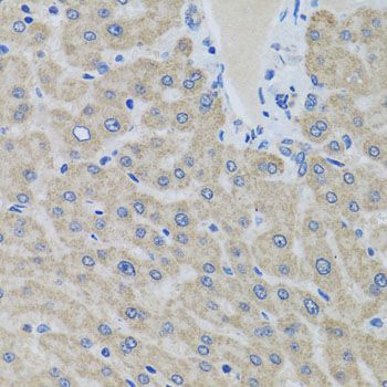 Immunohistochemistry - EIF2S3 antibody (144-06581)