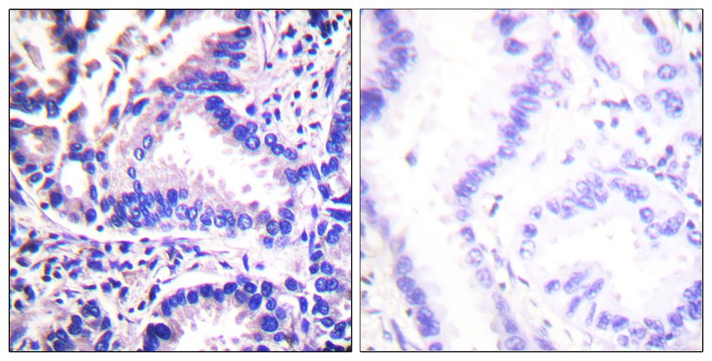 IHC