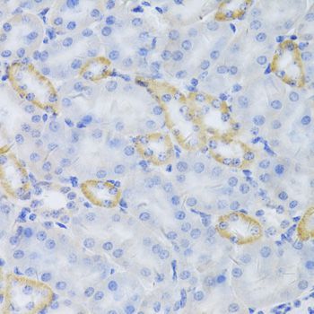Immunohistochemistry - MRPS30 Polyclonal Antibody (144-05841)