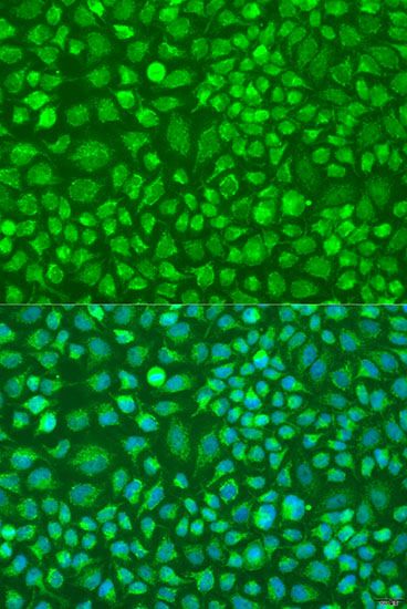 Immunofluorescence - DNAL1 antibody (144-08267)