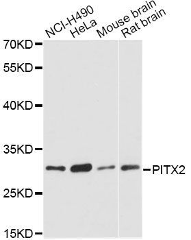 Western blot - PITX2 antibody (144-61323)