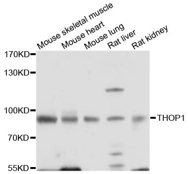 Western blot - THOP1 antibody (144-08756)