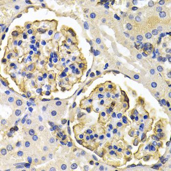 Immunohistochemistry - KLKB1 antibody (144-05318)