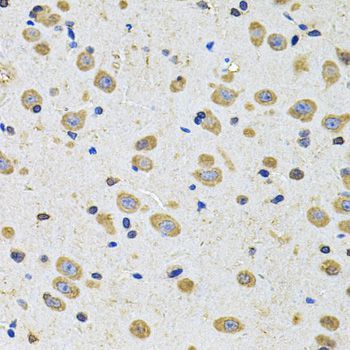 Immunohistochemistry - EPHA2 Antibody (144-07183)