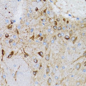 Immunohistochemistry - PGRMC1 antibody (144-05619)