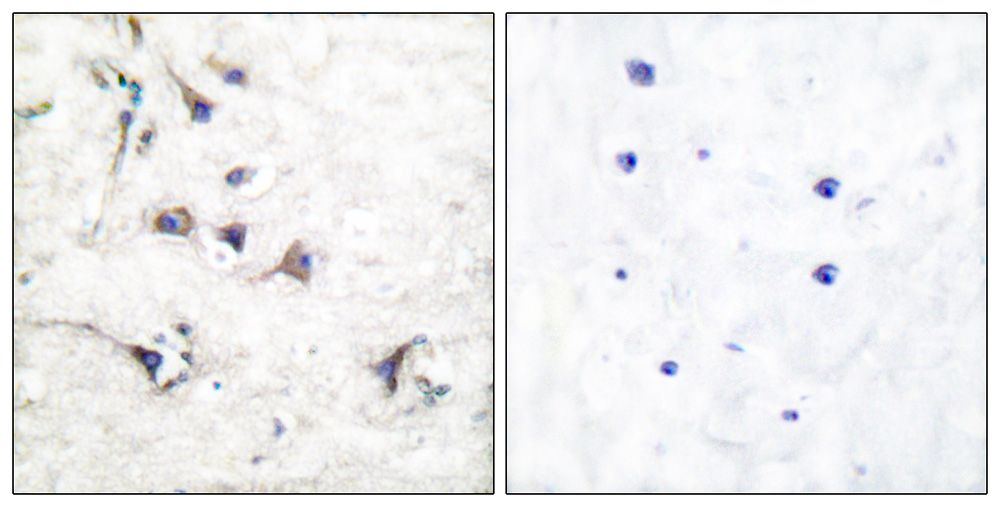 IHC