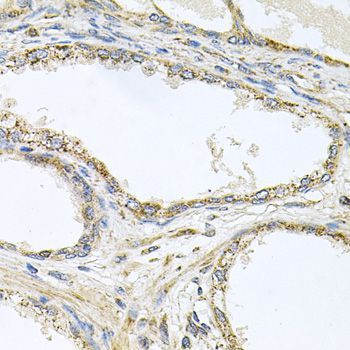 Immunohistochemistry - TNFRSF10A Polyclonal Antibody (144-06267)