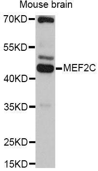 Western blot - MEF2C Polyclonal Antibody (144-012385)