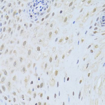 Immunohistochemistry - [KO Validated] AIFM1 Polyclonal Antibody (144-02568)