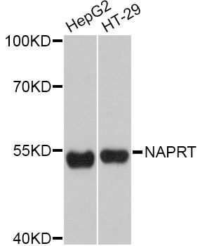 Western blot - NAPRT Polyclonal Antibody (144-011591)