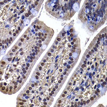 Immunohistochemistry - DNAJB6 Polyclonal Antibody (144-07052)