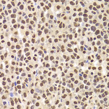 Immunohistochemistry - ANP32A Antibody (144-05768)
