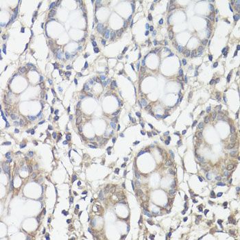 Immunohistochemistry - PTK2 Polyclonal Antibody (144-60065)