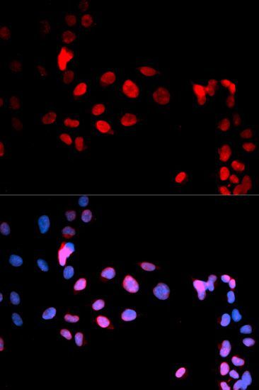 Immunofluorescence - Phospho-MAX-S11 antibody (144-50072)