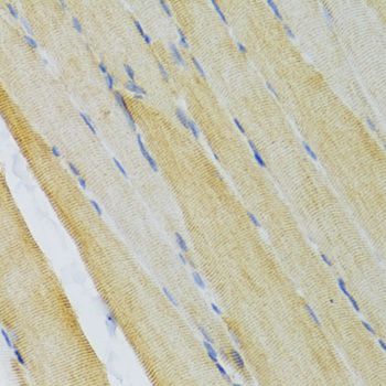 Immunohistochemistry - EDA Antibody (144-02905)