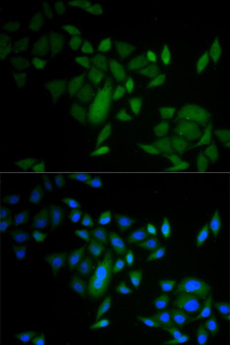 Immunofluorescence - CASP9 antibody (144-02636)