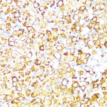 Immunohistochemistry - NAMPT Polyclonal Antibody (144-00256)