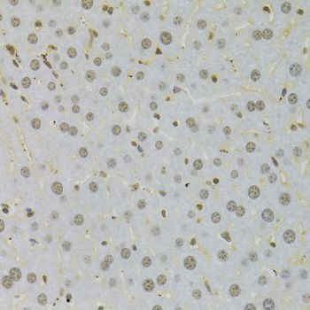 Immunohistochemistry - HMGB1 Polyclonal Antibody (144-02553)