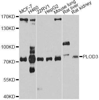 Western blot - PLOD3 Polyclonal Antibody (144-010547)