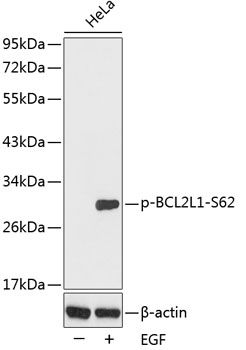 Western blot