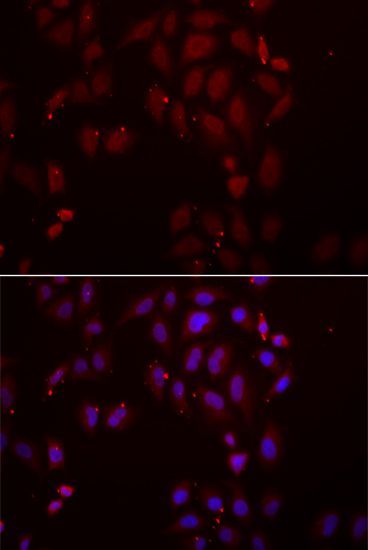 Immunofluorescence - FRZB Polyclonal Antibody (144-06592)