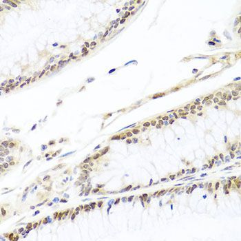 Immunohistochemistry - HIRA antibody (144-08461)