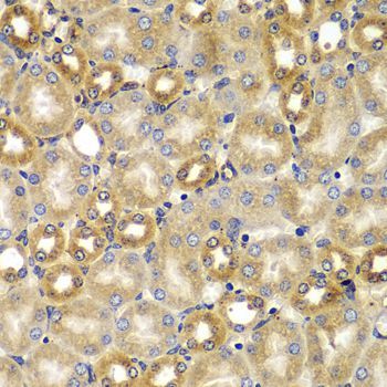 Immunohistochemistry - SMAD9 antibody (144-07518)