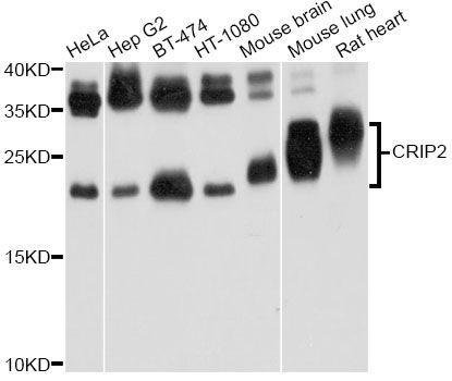 Western blot - CRIP2 Antibody (144-09038)