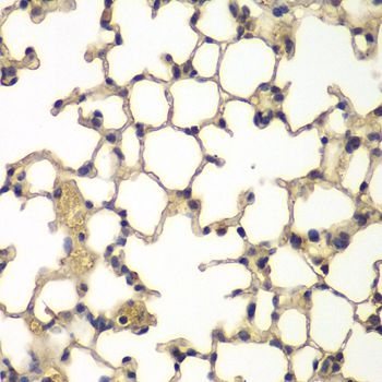 Immunohistochemistry - IFRD1 Polyclonal Antibody (144-07439)