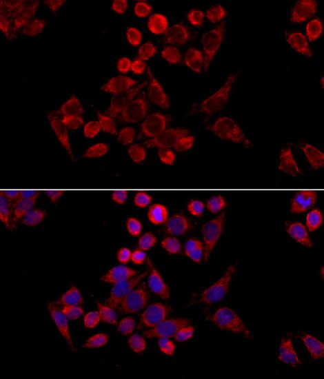 Immunofluorescence - TOMM20 antibody (144-06774)