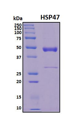 SDS-PAGE