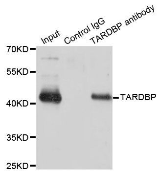 Immunofluorescence - TARDBP Polyclonal Antibody (144-01183)