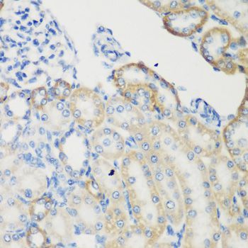 Immunohistochemistry - TGM5 antibody (144-07039)