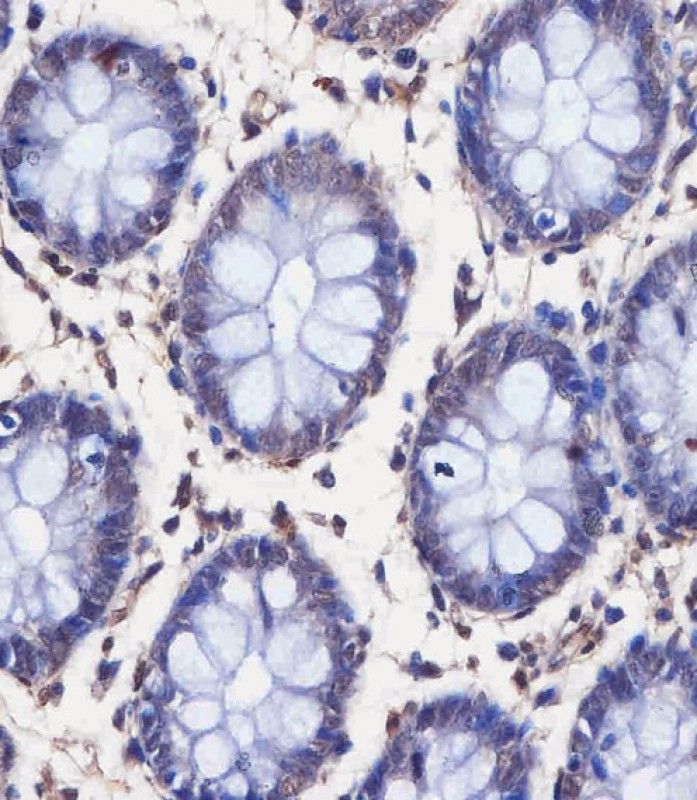 IHC-P