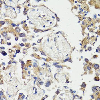 Immunohistochemistry - FOS Polyclonal Antibody (144-00236)