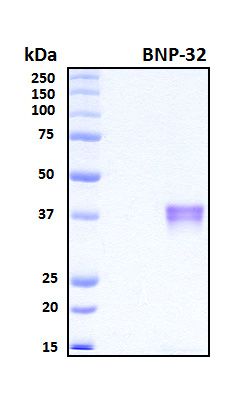 SDS-PAGE