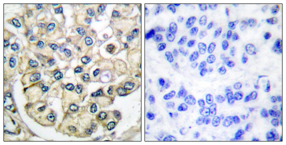 IHC