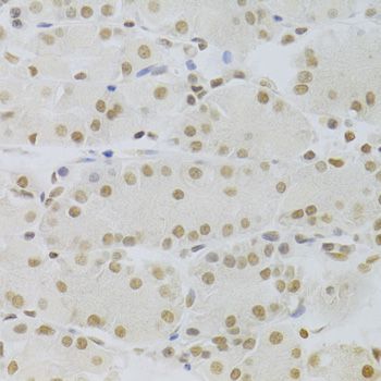 Immunohistochemistry - HMGB1 Polyclonal Antibody (144-02553)