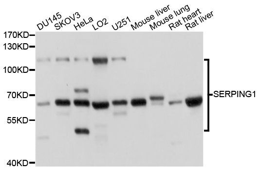Western blot - SERPING1 antibody (144-01717)