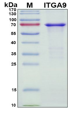 SDS-PAGE