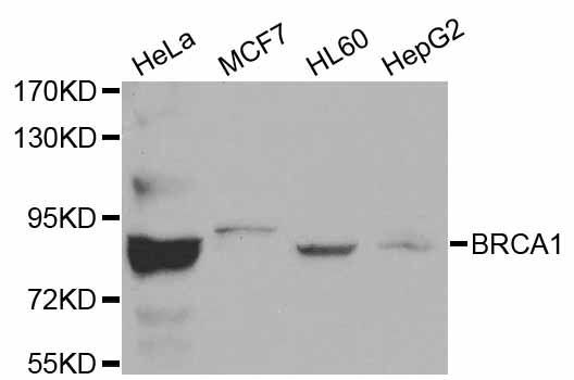 Western blot - BRCA1 Polyclonal Antibody (144-00212)